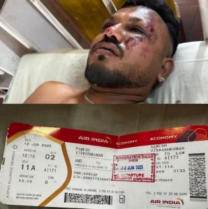 The Miraculous Survival of Ramesh Vishwaskumar in Ahmedabad Plane Crash