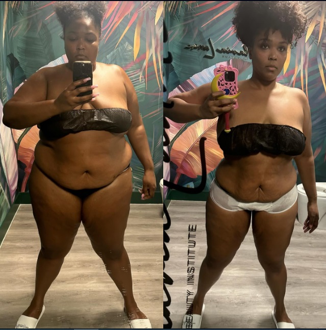 Lizzo Before and After Weight Loss Photos