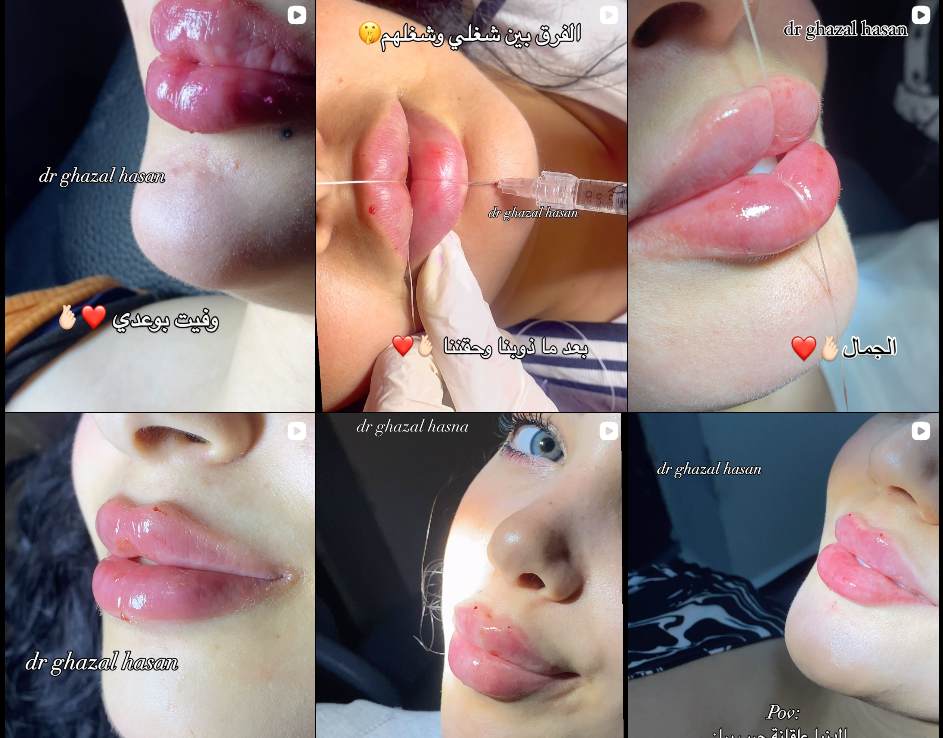 Dr Ghazal Hasan Damascus Hama Masyaf